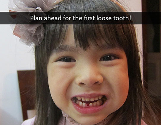 Plan Ahead for the First Loose Tooth!